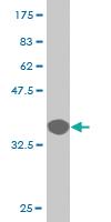 Anti-RPS6KA3 Mouse Monoclonal Antibody [clone: 2G10]