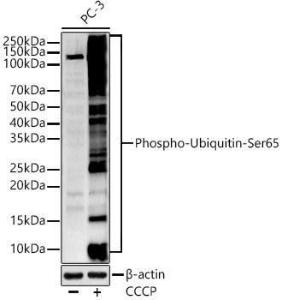 Anti-Ubiquitin antibody