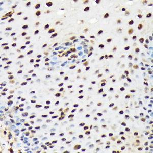 Immunohistochemistry analysis of paraffin-embedded human esophageal using Anti-PRP19 Antibody [ARC1685] (A305915) at a dilution of 1:100 (40x lens). Perform microwave antigen retrieval with 10 mM Tris/EDTA buffer pH 9.0 before commencing with IHC staining protocol.