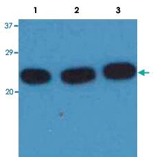 Anti-HRAS Mouse Monoclonal Antibody [clone: H-RAS-03]