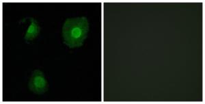 Immunofluorescence analysis of A549 cells using Anti-EID1 Antibody. The right hand panel represents a negative control, where the antibody was pre-incubated with the immunising peptide