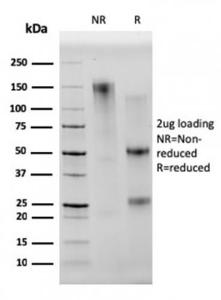 SDS-PAGE analysis of Anti-CD68 Antibody [C68/2501] under non-reduced and reduced conditions; showing intact IgG and intact heavy and light chains, respectively. SDS-PAGE analysis confirms the integrity and purity of the antibody