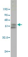 Anti-UBE2S Mouse Monoclonal Antibody [clone: 3D5]