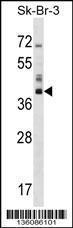 Anti-HSD17B1 Rabbit Polyclonal Antibody (APC (Allophycocyanin))