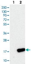 Anti-PLGRKT Rabbit Polyclonal Antibody