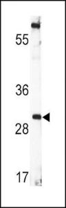 Anti-BDNF Rabbit polyclonal antibody unconjugated