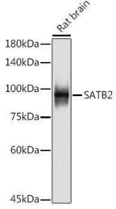 Western blot analysis of extracts of Rat brain, using Anti-SATB2 Antibody [ARC2363] (A308738) at 1:500 dilution