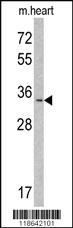 Anti-MLF1 Rabbit Polyclonal Antibody