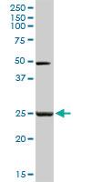 Anti-MYOG Rabbit Polyclonal Antibody