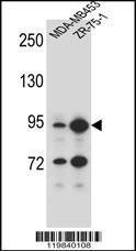 Anti-SCUBE2 Rabbit Polyclonal Antibody (APC (Allophycocyanin))