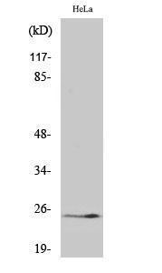 Western blot analysis of various cells using Anti-Kallikrein-11 (cleaved Ile54) Antibody