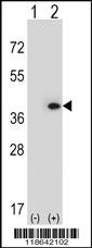 Anti-MLF1 Rabbit Polyclonal Antibody