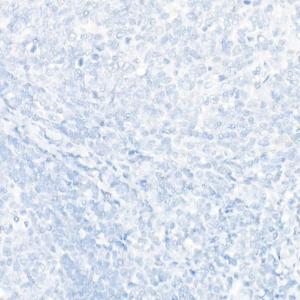 Immunohistochemistry analysis of paraffin-embedded human tonsil (negative control sample) using Anti-SATB2 Antibody [ARC2363] (A308738) at a dilution of 1:100 (40X lens). Perform high pressure antigen retrieval with 10 mM citrate buffer pH 6.0 before commencing with IHC staining protocol