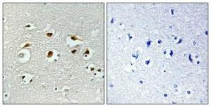 Immunohistochemical analysis of paraffin-embedded human brain using Anti-EID1 Antibody 1:100 (4 °C overnight). The right hand panel represents a negative control, where the antibody was pre-incubated with the immunising peptide