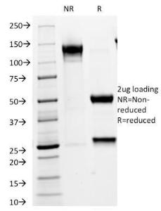 SDS-PAGE analysis of Anti-VLDL Receptor Antibody [VLDLR/1337] under non-reduced and reduced conditions; showing intact IgG and intact heavy and light chains, respectively. SDS-PAGE analysis confirms the integrity and purity of the antibody