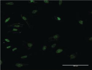 Anti-HMGB2 Mouse Monoclonal Antibody [clone: X1]