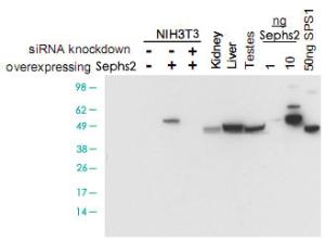 Anti-SEPHS2 Rabbit Polyclonal Antibody