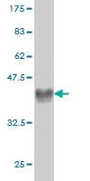 Anti-CRIM1 Mouse Monoclonal Antibody [clone: 6E4]