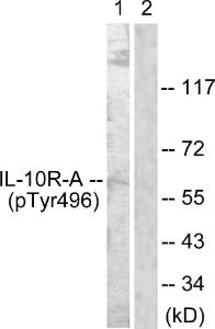 Western blot analysis of lysates from HUVEC cells using Anti-IL-10R alpha (phospho Tyr496) Antibody. The right hand lane represents a negative control, where the antibody is blocked by the immunising peptide.