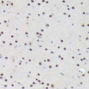 Immunohistochemistry analysis of paraffin-embedded mouse brain using Anti-PRP19 Antibody [ARC1685] (A305915) at a dilution of 1:100 (40x lens). Perform microwave antigen retrieval with 10 mM Tris/EDTA buffer pH 9.0 before commencing with IHC staining protocol.