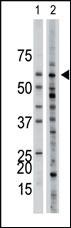 Anti-ACVR1 Rabbit Polyclonal Antibody