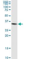 Anti-STX11 Rabbit Polyclonal Antibody