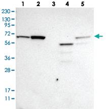 Anti-ME2 Rabbit Polyclonal Antibody