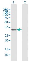 Anti-STX11 Rabbit Polyclonal Antibody