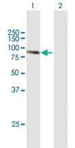 Anti-TGM1 Mouse Polyclonal Antibody