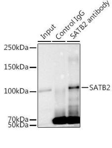 Immunoprecipitation analysis of 300 µg extracts of K-562 cells using 3 µg of Anti-SATB2 Antibody [ARC2363] (A308738). This Western blot was performed on the immunoprecipitate using Anti-SATB2 Antibody [ARC2363] (A308738) at a dilution of 1:1000