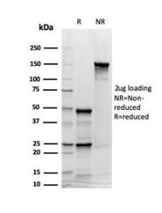 SDS-PAGE analysis of Anti-Synaptophysin Antibody [rSYP/6856] under non-reduced and reduced conditions; showing intact IgG and intact heavy and light chains, respectively. SDS-PAGE analysis confirms the integrity and purity of the antibody.