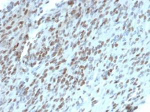 Anti-TLE1 Mouse Monoclonal Antibody [clone: TLE1/2062]