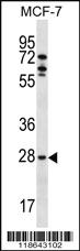 Anti-MLF1 Rabbit Polyclonal Antibody