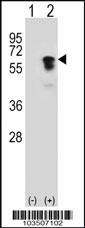 Anti-ACVR1 Rabbit Polyclonal Antibody