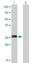 Anti-MYOG Mouse Monoclonal Antibody [clone: 2B7]