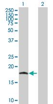 Anti-IL17C Mouse Polyclonal Antibody