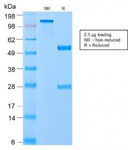 Anti-VLDL Receptor antibody