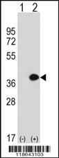 Anti-MLF1 Rabbit Polyclonal Antibody