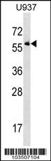 Anti-ACVR1 Rabbit Polyclonal Antibody