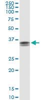 Anti-STX11 Rabbit Polyclonal Antibody