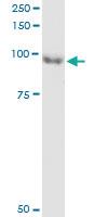 Anti-Rac/Cdc42 guanine nucleotide exchange Factor (GEF) 6 Mouse Monoclonal Antibody