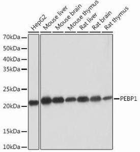 Western blot analysis of extracts of various cell lines, using Anti-RKIP Antibody [ARC0704] (A307652) at 1:1,000 dilution. The secondary antibody was Goat Anti-Rabbit IgG H&L Antibody (HRP) at 1:10,000 dilution.