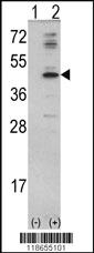 Anti-MVD Rabbit Polyclonal Antibody