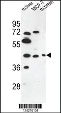 Anti-PSG3 Rabbit Polyclonal Antibody