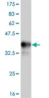 Anti-TLR9 Mouse Monoclonal Antibody [clone: 2C3]