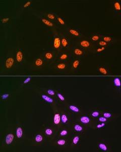 Immunofluorescence analysis of U-2 OS cells using Anti-PRP19 Antibody [ARC1685] (A305915) at a dilution of 1:100 (40x lens). DAPI was used to stain the cell nuclei (blue).