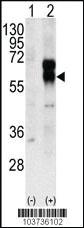 Anti-ACVRL1 Rabbit Polyclonal Antibody