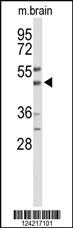 Anti-WIPI2 Rabbit Polyclonal Antibody