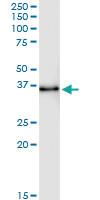 Anti-STX11 Rabbit Polyclonal Antibody