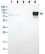 Anti-ACTN2 Rabbit Polyclonal Antibody